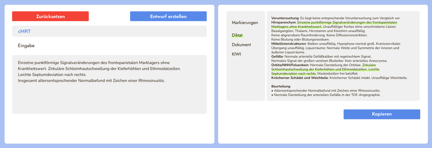 KIWI Befundungs-Interface: Diktat links, strukturierter Befundentwurf rechts